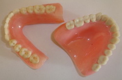 съемные зубные протезы